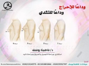 WhatsApp Image 2020 09 10 at 9.35.10 PM عيادة التجميل والحروق وجراحات اليد. د/ فاطمة يوسف