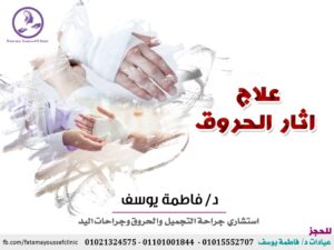 WhatsApp Image 2020 09 10 at 9.35.11 PM 1 عيادة التجميل والحروق وجراحات اليد. د/ فاطمة يوسف