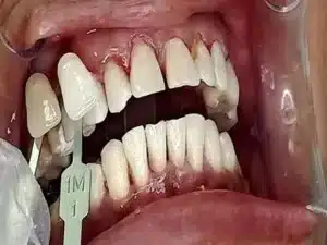 Dalia Abd ElMougood 10 Dr/Dalia Abd ElMougood Dental Clinic لعلاج وتجميل الاسنان