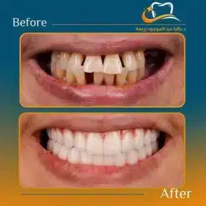 Dalia Abd ElMougood 4 Dr/Dalia Abd ElMougood Dental Clinic لعلاج وتجميل الاسنان