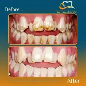 Dalia Abd ElMougood 6 Dr/Dalia Abd ElMougood Dental Clinic لعلاج وتجميل الاسنان