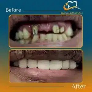 Dalia Abd ElMougood 7 Dr/Dalia Abd ElMougood Dental Clinic لعلاج وتجميل الاسنان