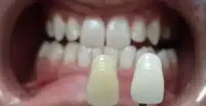 Dalia Abd ElMougood 8 Dr/Dalia Abd ElMougood Dental Clinic لعلاج وتجميل الاسنان