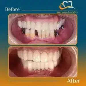 Dalia Abd ElMougood 9 Dr/Dalia Abd ElMougood Dental Clinic لعلاج وتجميل الاسنان