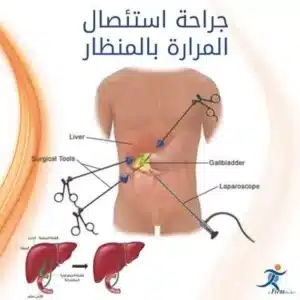 الدكتور أحمد عبد السلام عبد القادر عقيد دكتور استشاري الجراحة العامة والمناظير والأورام بمستشفيات القوات المسلحة